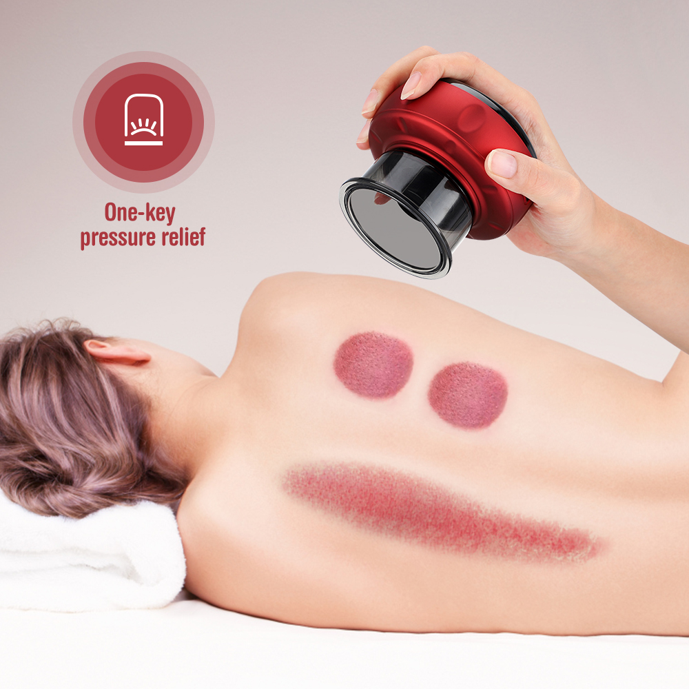 Smart Electric Cupping Massage Device – Negative Pressure Therapy with Heat & Red Light